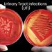 UTI