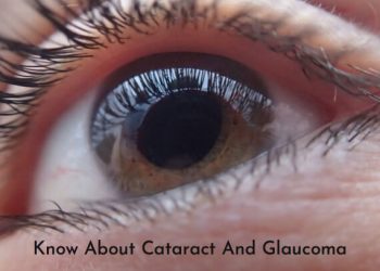 Know About Cataract And Glaucoma