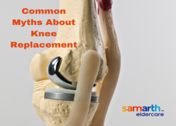 Myths related to Knee Replacement