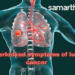 Symptoms of Lung Cancer